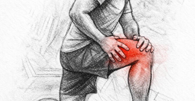 Knee Pain When Running or Squatting image