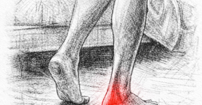 Heel Pain When Walking – Plantar Fasciitis Treatment image