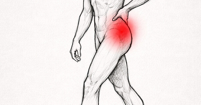 Hip Pain When Walking or Standing image